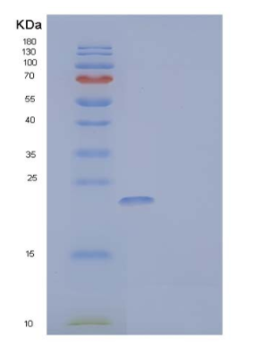 Recombinant Mouse NKG2D Ligand 1/NKG2DL/ULBP1 Protein(C-6His)
