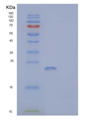 Recombinant Mouse SLAM Family Member 7 Protein