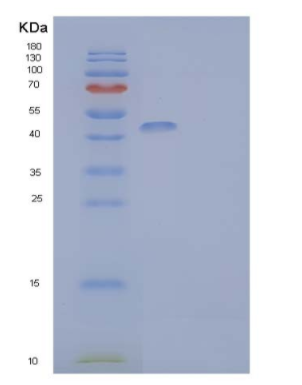 Recombinant Mouse HLADG/CD74 Protein(C-mFc-6His)
