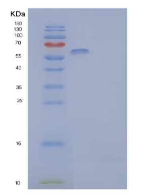 Recombinant Human IL-1 Receptor-Like 2/IL-1RL2 Protein(C-Fc)