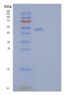 Eukaryotic Interleukin 2 Receptor Alpha (IL2Ra)