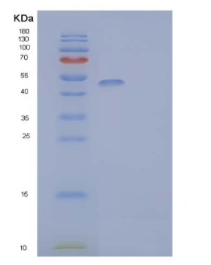 Recombinant Human Lymphocyte Activation Gene 3 Protein Protein