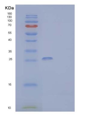 Recombinant Human CMRF35-Like Molecule 9 Protein