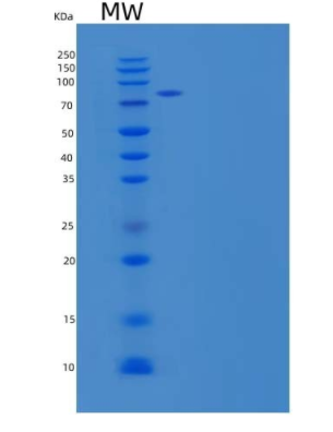 Recombinant Human Brain-Specific Angiogenesis Inhibitor 3/BAI3 Protein(C-6His)