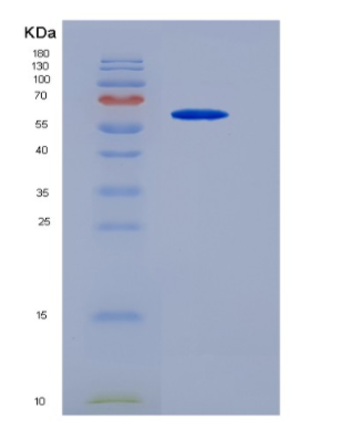 Eukaryotic Chemokine C-X3-C-Motif Ligand 1 (CX3CL1)