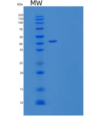 Recombinant Human CD99 Antigen-Like Protein 2/CD99L2 Protein(C-Fc)