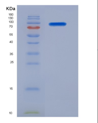 Eukaryotic Cluster Of Differentiation 56 (CD56)
