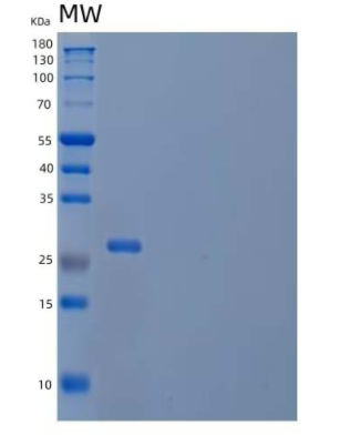 Recombinant Human Thiamin Pyrophosphokinase 1/TPK1 Protein(C-6His)