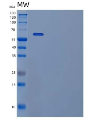Recombinant Human Copine-1/CPNE1 Protein(N, C-6His)