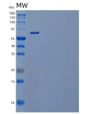 Recombinant Mouse IL-1 Receptor Type 2/IL-1R-2 Protein(C-Fc)