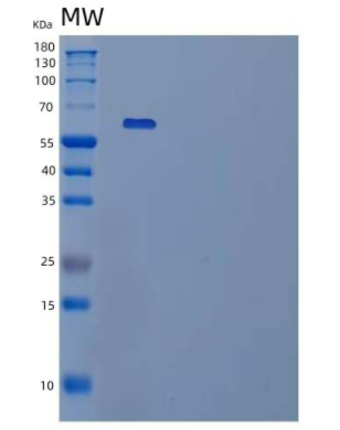 Recombinant Human IL-1 Receptor Type 2/IL-1R-2 Protein(C-Fc)