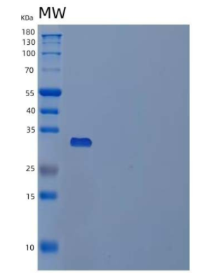 Recombinant Human Palmitoyl-Protein Thioesterase 1/PPT1 Protein(C-6His)