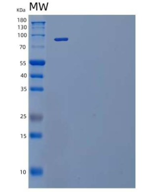 Recombinant Mouse IL-12 Receptor Subunit β2/IL-12RB2 Protein(C-Fc)