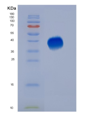 Eukaryotic Programmed Cell Death Protein 1 (PD1)
