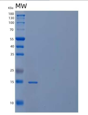 Recombinant Human PDCD5/TFAR19 Protein(N-6His)