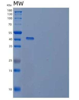 Recombinant Human Peptidyl-Prolyl Cis-Trans Isomerase D/PPID/PPIase D Protein(N, C-6His)