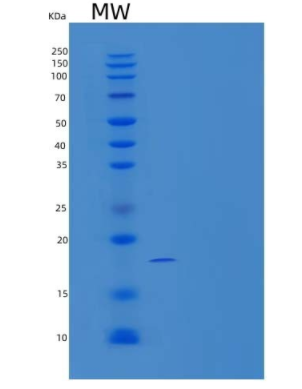 Recombinant Mouse Neuroblastoma Suppressor of Tumorigenicity 1/NBL1 Protein(C-6His)