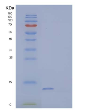 Recombinant Human Protein FAM19A4/FAM19A4 Protein(N-6His)