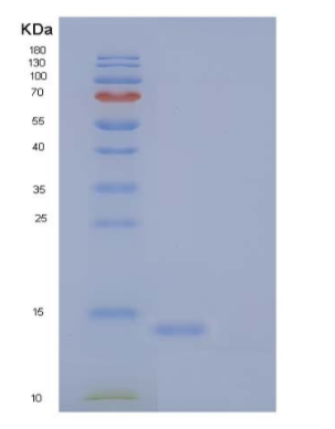 Recombinant Human BOC Protein/BOC Protein(C-6His)