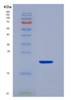 Recombinant Human CD16b / FCGR3B Protein, Biotinylated
