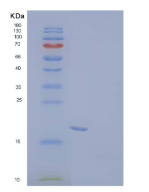 Recombinant Human Vesicle-associated membrane protein-associated protein B Protein