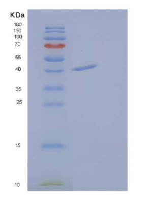 Recombinant Human Calreticulin-3/CALR3/CRT2 Protein