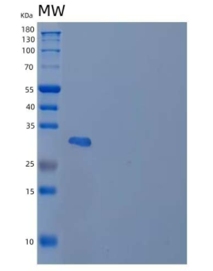 Recombinant Human Carbonic Anhydrase 3/CA3 Protein(C-6His)