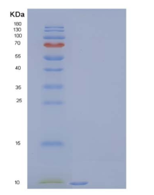 Recombinant Human C-C Motif Chemokine 11/CCL11/Eotaxin Protein