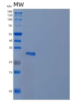 Recombinant Human Follistatin-Related Protein 1/FSTL1 Protein