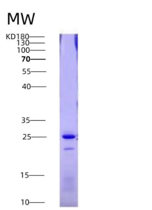 Eukaryotic Factor Related Apoptosis (FAS)