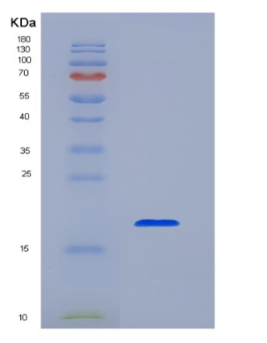 Eukaryotic Membrane Spanning 4 Domains Subfamily A, Member 1 (CD20)
