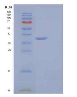 Recombinant Human Interleukin-1 receptor type 1/IL-1R-1 Protein