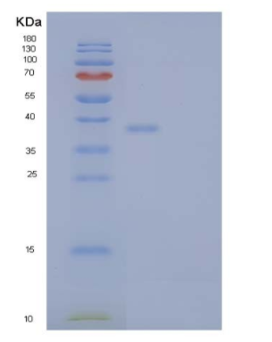Recombinant Human Interleukin-1 receptor type 2/IL-1R-2 Protein