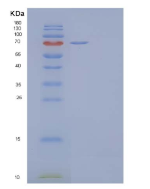 Recombinant Human Interleukin-35 Protein