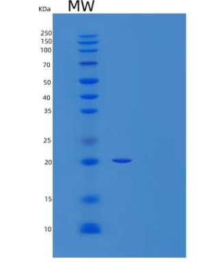 Recombinant Human Galectin-Related Protein/LGALSL Protein(C-6His)