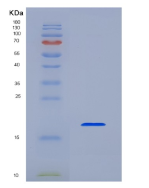 Recombinant Human Interleukin 1 Beta (IL1b)