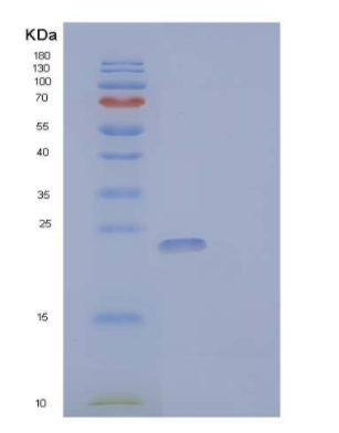 Recombinant Human Granulocyte Colony-Stimulating Factor/G-CSF Protein
