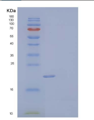 Recombinant Human SOD2/Mn-SOD Protein(N-6His)