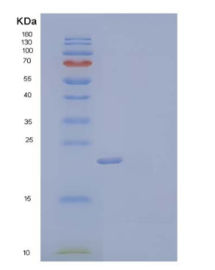 Recombinant Human Stathmin/STMN1 Protein(C-6His)
