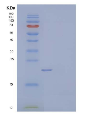 Recombinant Mouse C-X-C Motif Chemokine 16/CXCL16/SR-PSOX Protein(C-6His)