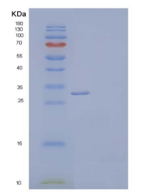 Recombinant Human CLEC10A/CD301 Protein(C-6His)