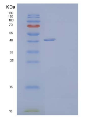 Recombinant Human Nogo-66 Receptor-Related 3/NgR3/RTN4RL1 Protein(C-6His)