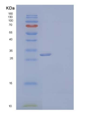 Recombinant Human CGREF1/CGR11 Protein(C-6His)