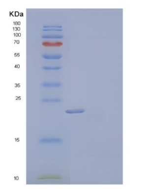 Recombinant Human High Mobility Group Protein B3/HMGB3 Protein(C-6His)