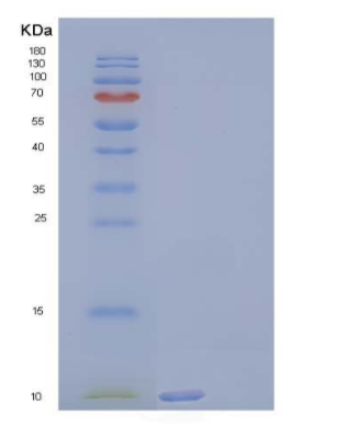 Recombinant Human Complement Component C3a/C3a Protein