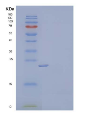 Recombinant Mouse Fibroblast Growth Factor 17/FGF-17 Protein(C-6His)