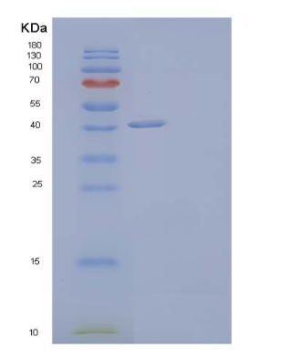 Recombinant Human Hyaluronidase-1/HYAL1 Protein(C-6His)