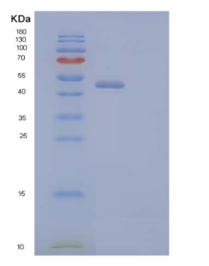 Recombinant Human Corneodesmosin/CDSN Protein(C-6His)