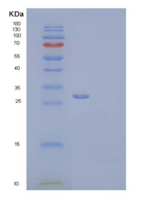 Recombinant Human Complement Factor H-Related Protein 2/CFHR2 Protein(C-6His)