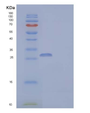 Recombinant Human Coronin-6/CORO6 Protein(N-6His)